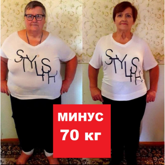 Богдана, 68 лет Во время курса - минус 3 кг После курса - еще минус 67 кг